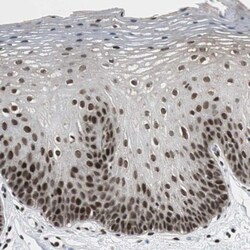 TSPYL6 Antibody, Novus Biologicals:Antibodies:Primary Antibodies